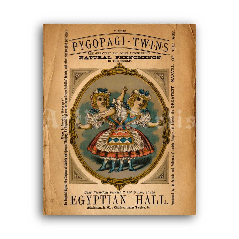 Printable Pygopagi Twins vintage freak show poster - vintage print poster