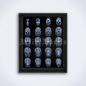 Printable MRI X-Ray Human Brain - medical radiology poster - vintage print poster