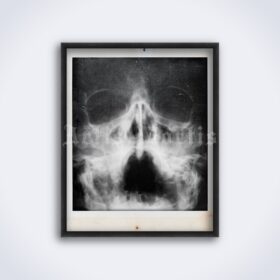 Printable X-Ray Human skull face - vintage medical radiology poster - vintage print poster