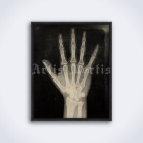 Printable X-Ray Human Hand - anatomy, medical radiology poster - vintage print poster