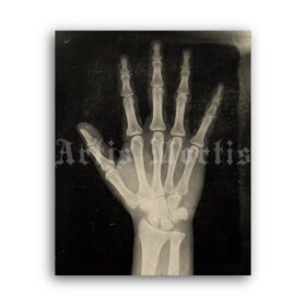 Printable X-Ray Human Hand - anatomy, medical radiology poster - vintage print poster