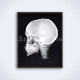 Printable X-Ray Human skull lateral view - medical radiology poster - vintage print poster