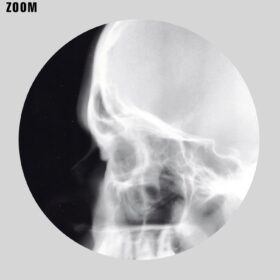 Printable X-Ray Human skull lateral view - medical radiology poster - vintage print poster