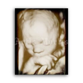 Printable X-Ray Human Fetus, embryo - vintage medical radiology poster - vintage print poster