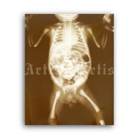 Printable X-Ray Human child body - vintage medical radiology poster - vintage print poster