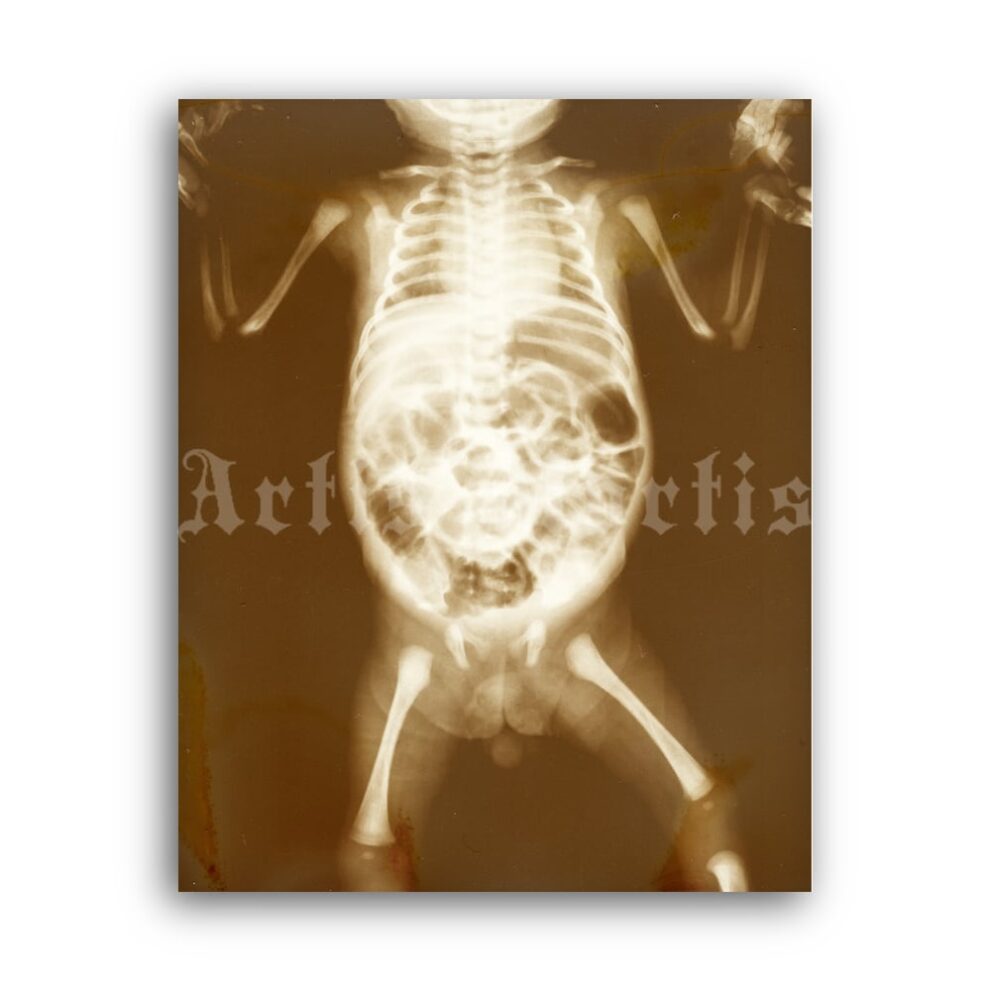 Printable X-Ray Human child body - vintage medical radiology poster - vintage print poster