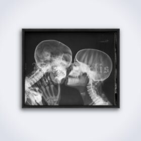 Printable X-Ray kiss, kissing skeletons - vintage medical radiology poster - vintage print poster