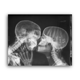 Printable X-Ray kiss, kissing skeletons - vintage medical radiology poster - vintage print poster