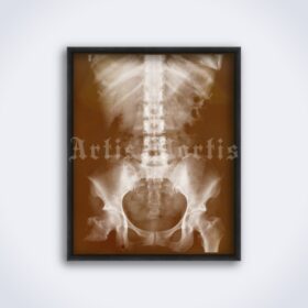 Printable X-Ray Skeleton torso bones - vintage medical radiology poster - vintage print poster