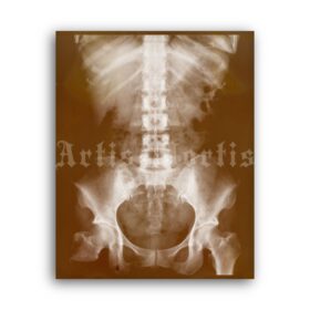 Printable X-Ray Skeleton torso bones - vintage medical radiology poster - vintage print poster