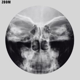 Printable X-Ray Human skull - vintage medical radiology poster - vintage print poster