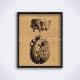Printable Rustic human skull – anatomy, skull art, Osteographia poster - vintage print poster