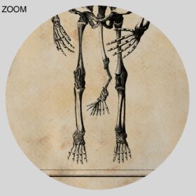 Printable Conjoined skeletons, siamese twins – vintage medical print - vintage print poster