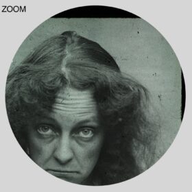 Printable Lunatic woman, hysteria - vintage psychiatry educational photo - vintage print poster