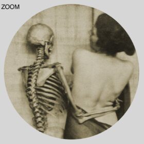 Printable Lady dancing with skeleton, vintage photo by Franz Fiedler - vintage print poster